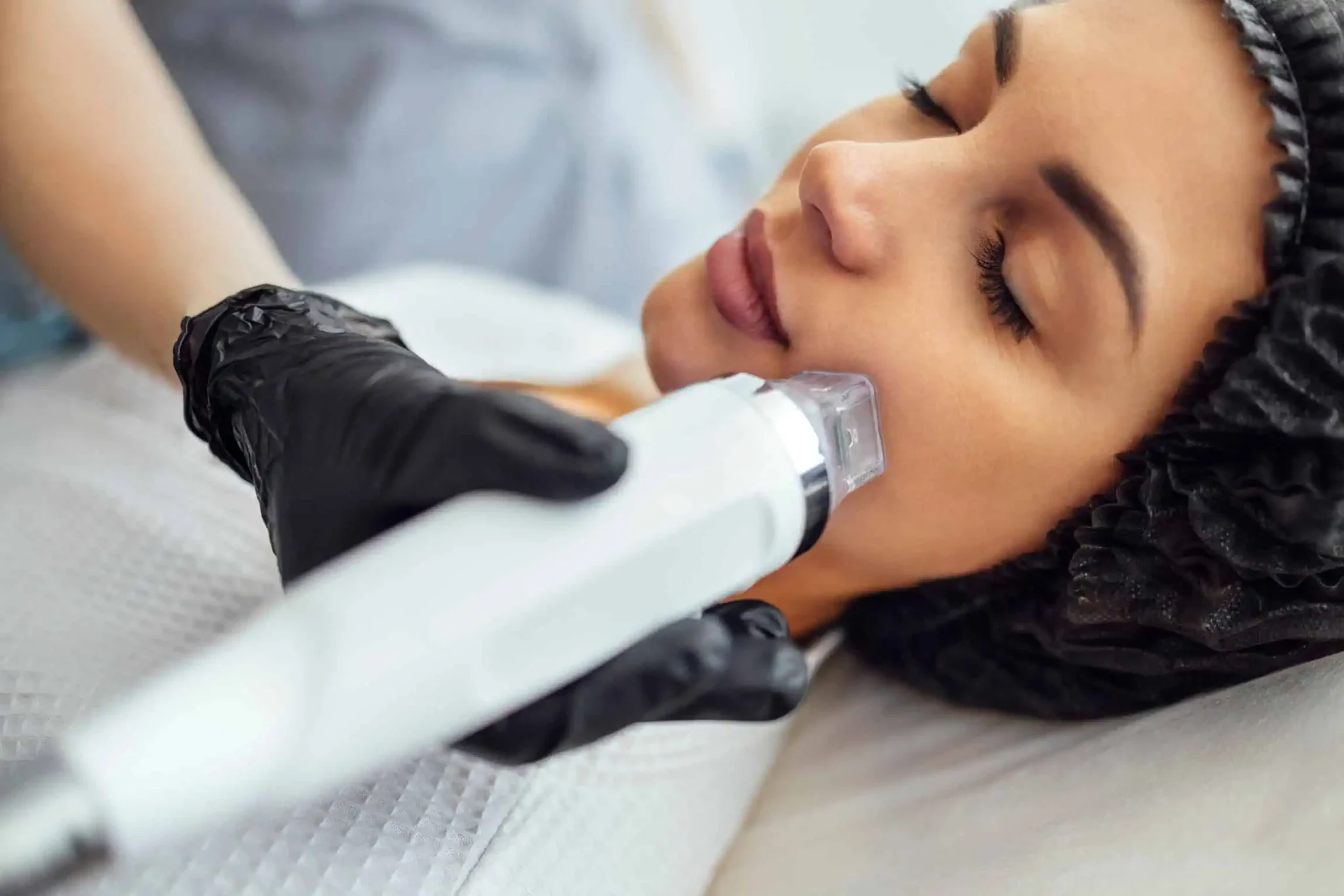 Microneedling by Juvenessence Medical Aesthetics in Pueblo, CO