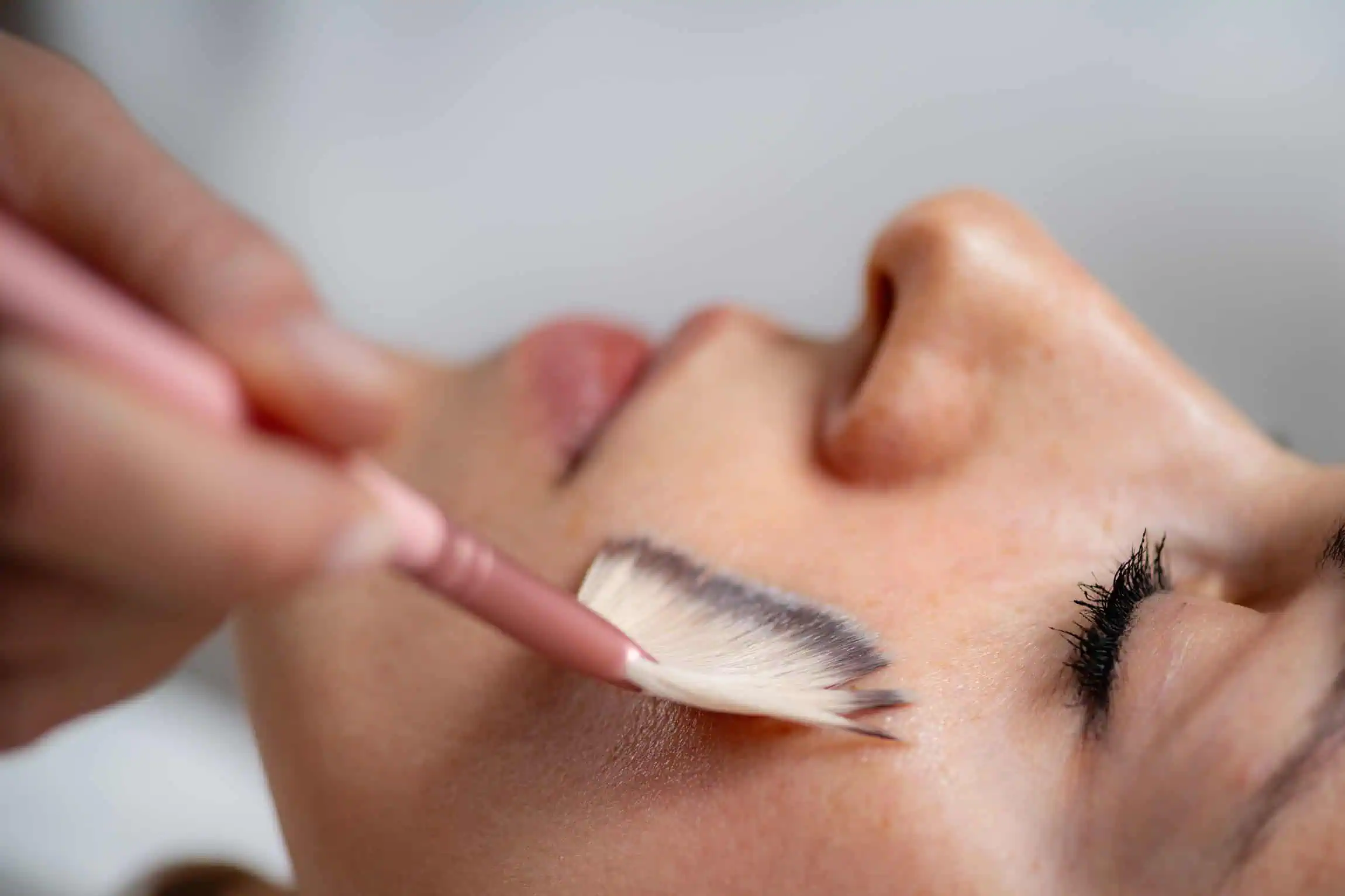 Cool Peel Treatment by Juvenessence Medical Aesthetics