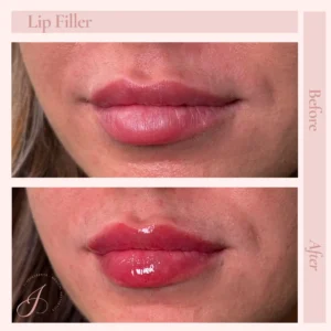 A Before and After Treatment Images in Pueblo, CO