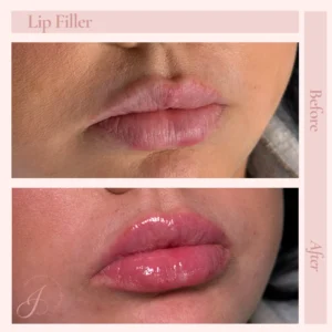 B Before and After Treatment Images in Pueblo, CO