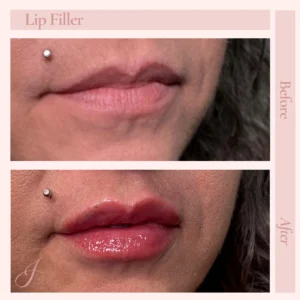 C Before and After Treatment Images in Pueblo, CO
