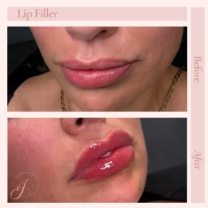 D Before and After Treatment Images in Pueblo, CO