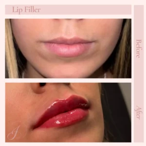 E Before and After Treatment Images in Pueblo, CO