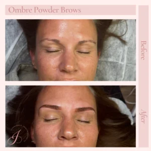 F Before and After Treatment Images in Pueblo, CO