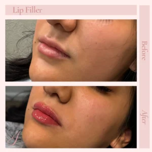 G Before and After Treatment Images in Pueblo, CO