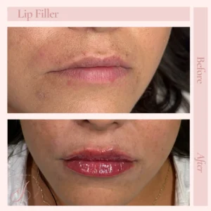 H Before and After Treatment Images in Pueblo, CO