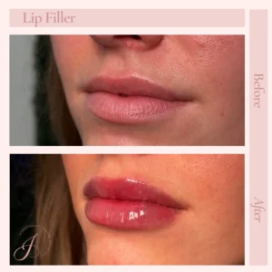 I Before and After Treatment Images in Pueblo, CO