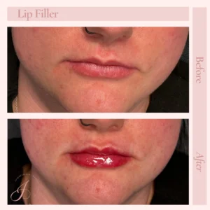 J Before and After Treatment Images in Pueblo, CO