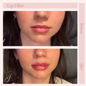 K Before and After Treatment Images in Pueblo, CO