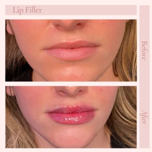 L Before and After Treatment Images in Pueblo, CO