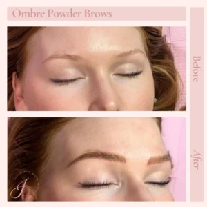 M Before and After Treatment Images in Pueblo, CO