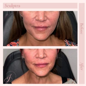 N Before and After Treatment Images in Pueblo, CO