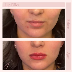 Q Before and After Treatment Images in Pueblo, CO