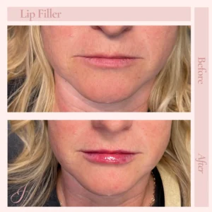 Before and After Treatment images by in Pueblo, CO