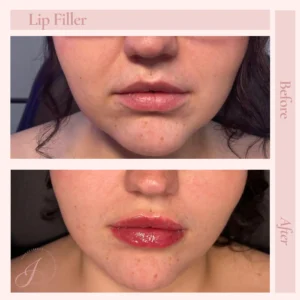 S Before and After Treatment Images in Pueblo, CO